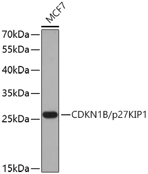 CDKN1B/p27KIP1 Polyclonal Antibody
