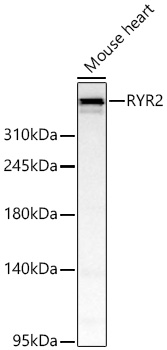 RYR2 Polyclonal Antibody