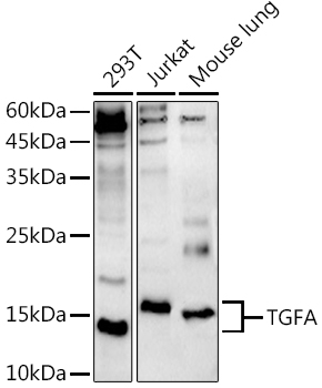 TGFA Polyclonal Antibody