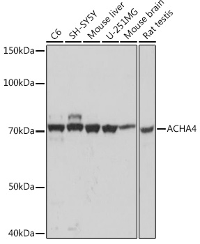 ACHA4 Monoclonal Antibody [1C2H2]&nbsp;<img src="images/icon_newarrival.gif" alt="new" border="0">