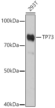 TP73 Polyclonal Antibody