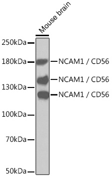 NCAM1 / CD56 Polyclonal Antibody