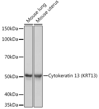 Cytokeratin 13 (KRT13) Monoclonal Antibody [5M6B10]