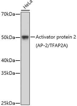 Activator protein 2 (AP-2/TFAP2A) Polyclonal Antibody&nbsp;<img src="images/icon_newarrival.gif" alt="new" border="0">