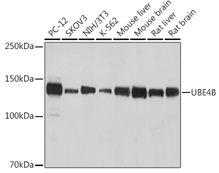 UBE4B Monoclonal Antibody [1D7K5]