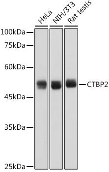 CTBP2 Monoclonal Antibody [1R1U6]