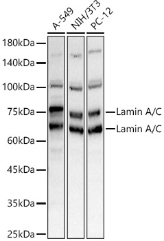 Lamin A/C Polyclonal Antibody