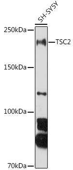TSC2 Polyclonal Antibody