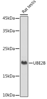UBE2B Monoclonal Antibody [2Z3R2]