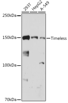 Timeless Monoclonal Antibody [6D4L2]