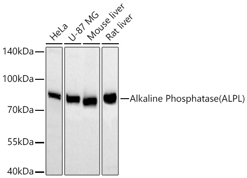 Alkaline Phosphatase (ALPL) Monoclonal Antibody [10B1M5]