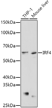 IRF4 Polyclonal Antibody