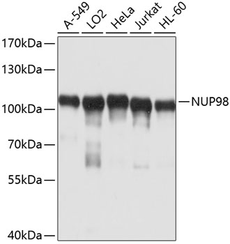 NUP98 Polyclonal Antibody