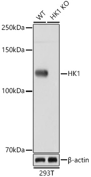 HK1 Monoclonal Antibody [6B7Q2]