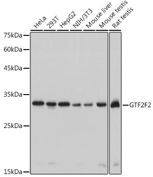 GTF2F2 Monoclonal Antibody [3T7Q9]
