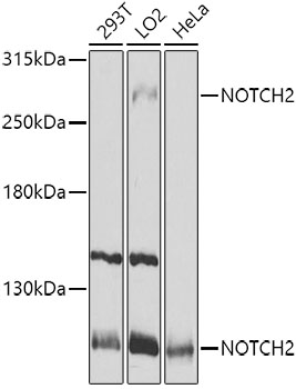 NOTCH2 Polyclonal Antibody
