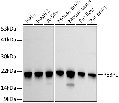 PEBP1 Polyclonal Antibody