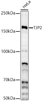 TJP2 Polyclonal Antibody