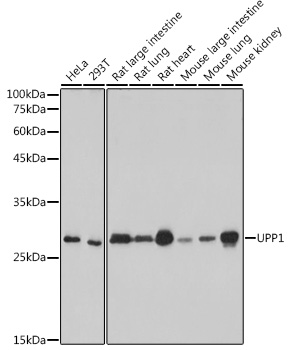 UPP1 Monoclonal Antibody [3E2I2]