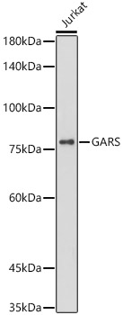GARS Monoclonal Antibody [5Q5D7]