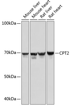 CPT2 Monoclonal Antibody [9V6M9]