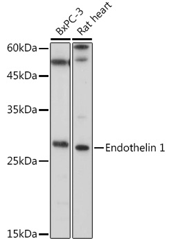 Endothelin 1 Polyclonal Antibody
