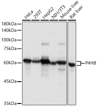 P4HB Polyclonal Antibody