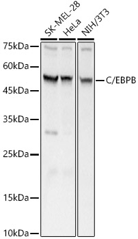 C/EBPB Polyclonal Antibody
