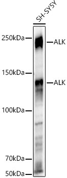 ALK Polyclonal Antibody