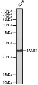 BRMS1 Monoclonal Antibody [5Y8J3]