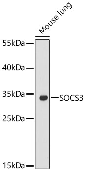SOCS3 Polyclonal Antibody