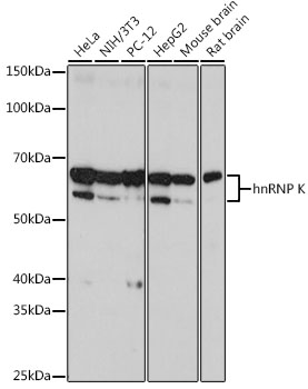 hnRNP K Monoclonal Antibody [3O5Y4]