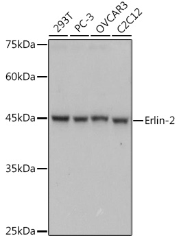 Erlin-2 Monoclonal Antibody [9T3M5]