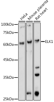 ELK1 Polyclonal Antibody