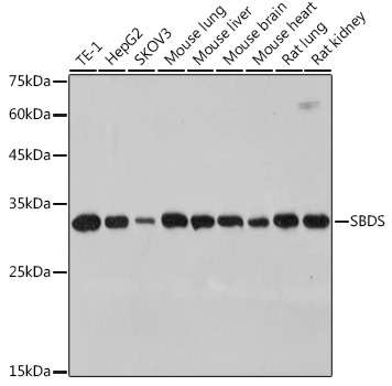 SBDS Monoclonal Antibody [9V4J9]