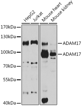 ADAM17 Polyclonal Antibody&nbsp;<img src="images/icon_newarrival.gif" alt="new" border="0">