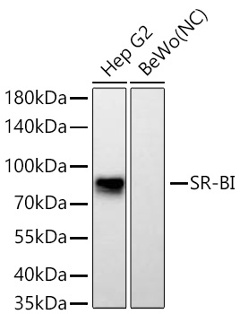 SR-BI Monoclonal Antibody [1C1I8]