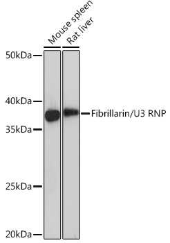 Fibrillarin/U3 RNP Monoclonal Antibody [9J5O2]