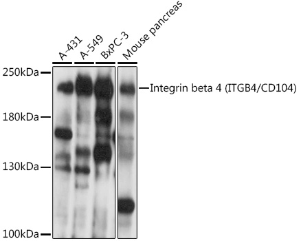 Integrin beta 4 (ITGB4/CD104) Polyclonal Antibody