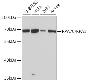 RPA70/RPA1 Polyclonal Antibody