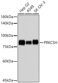 PRKCSH Monoclonal Antibody [4Z3K3]