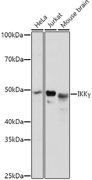 IKK-gamma Polyclonal Antibody