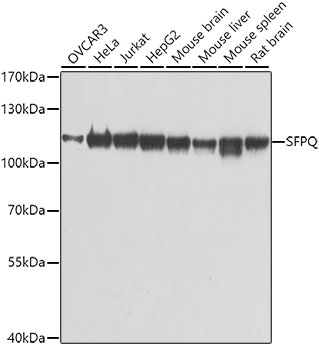 SFPQ Polyclonal Antibody