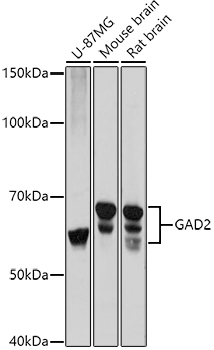 GAD65/GAD2 Polyclonal Antibody