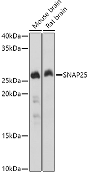 SNAP25 Polyclonal Antibody