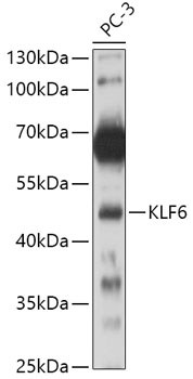 KLF6 Polyclonal Antibody