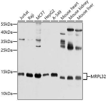 MRPL32 Polyclonal Antibody