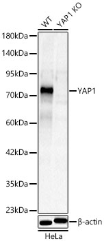 YAP1 Polyclonal Antibody