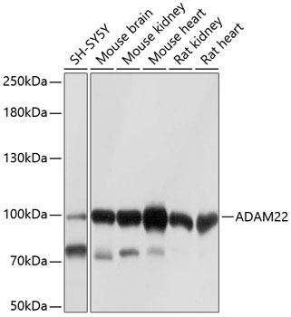 ADAM22 Polyclonal Antibody&nbsp;<img src="images/icon_newarrival.gif" alt="new" border="0">