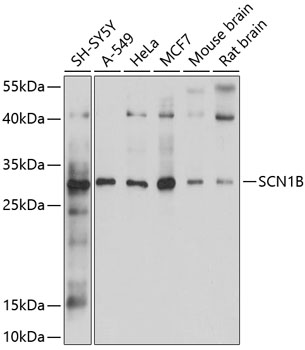 SCN1B Polyclonal Antibody